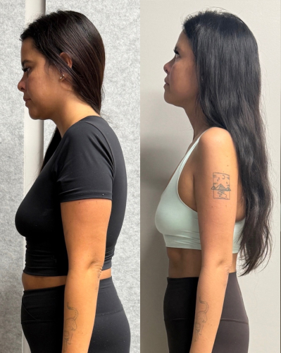 Glowlight Lost 11% body fat & 42lbs. in 6 months. Side