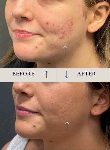 Glowlight Med Spa - Before and After