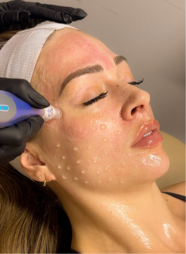 Glowlight Med Spa Woodinville WA