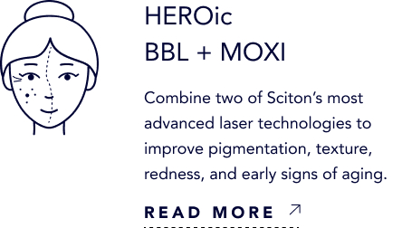 HEROic BBL + MOXI