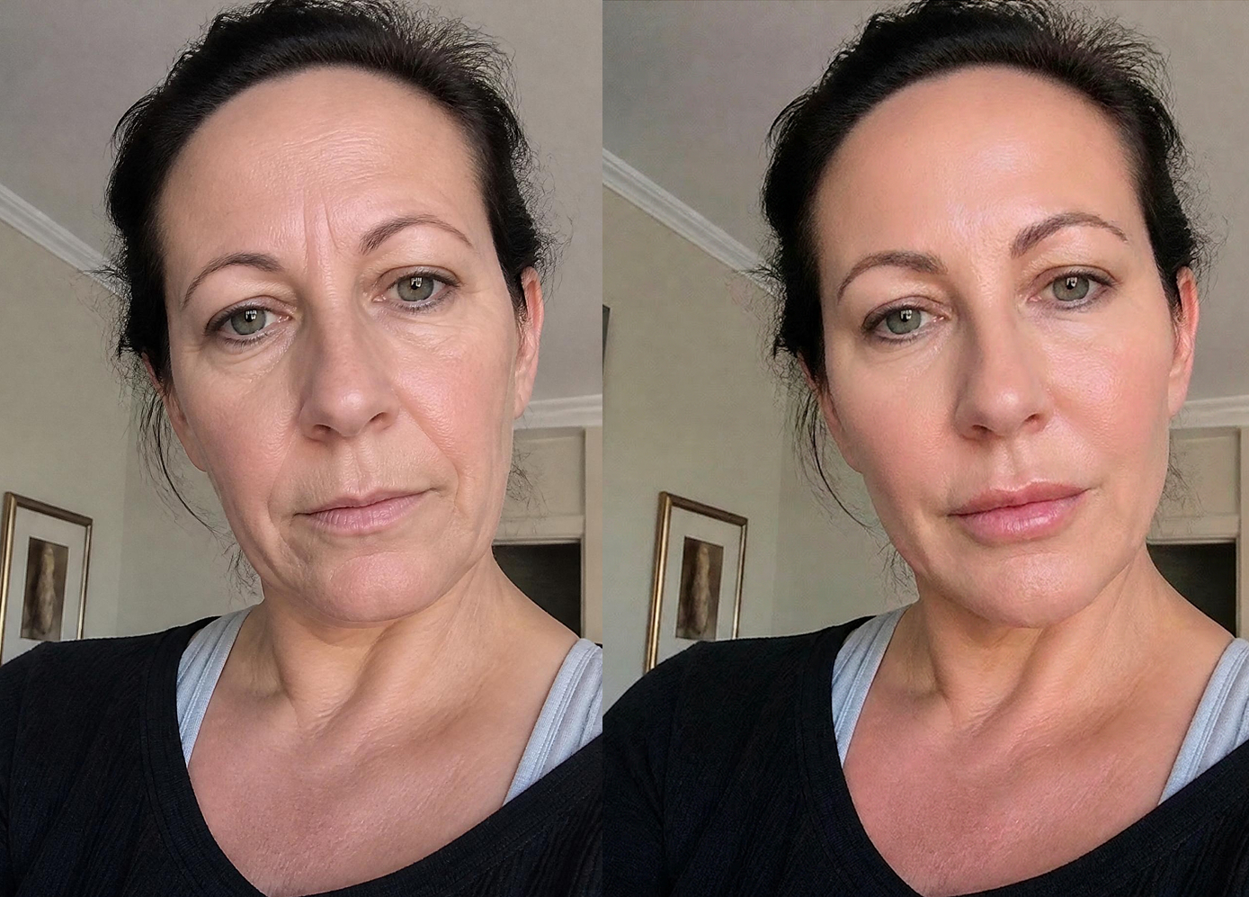 Your Future Face Beth before and after